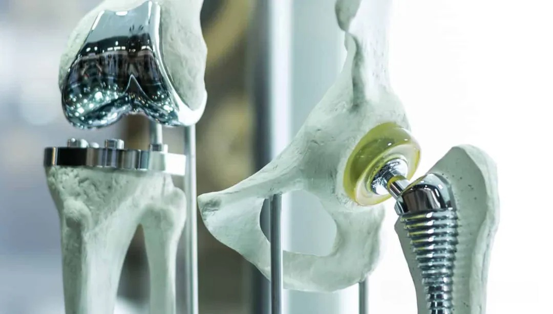 Medical Stainless Steel Explained – 304V, 316L, and 316LVM